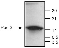 PEN2 | gamma-secretase subunit PEN-2 in the group Antibodies Human Cell Biology / Neuroscience / Neurodegenerative diseases / Alzheimer's disease at Agrisera AB (Antibodies for research) (AS06 154)